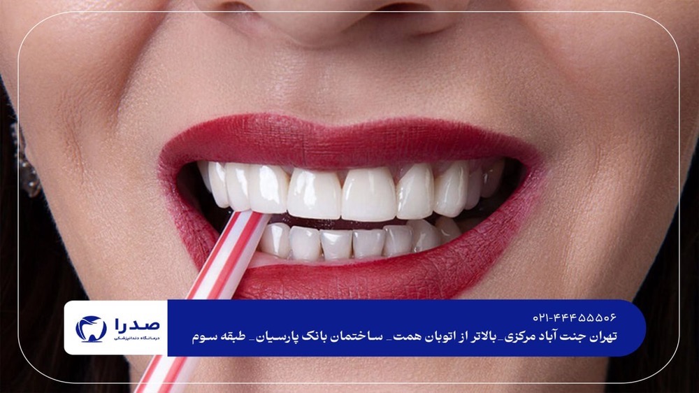  کامپوزیت و لمینت دندان