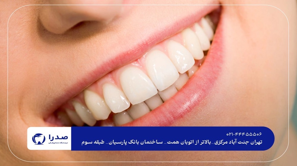 متخصص زیبایی دندان در تهران متخصص زیبایی دندان در تهران