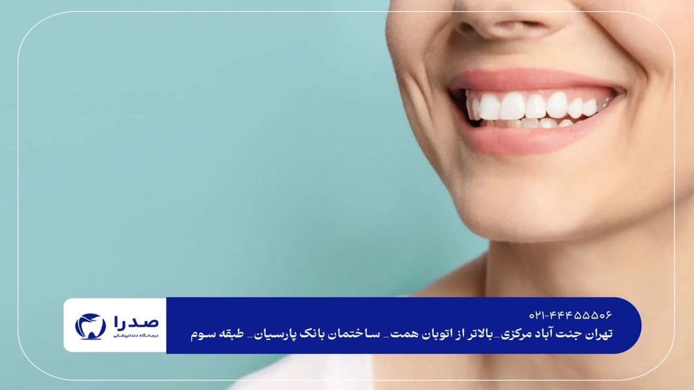 نوبتدهی متخصص زیبایی دندان در تهران نوبتدهی متخصص زیبایی دندان در تهران