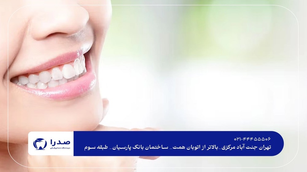 متخصص زیبایی دندان در تهران متخصص زیبایی دندان در تهران