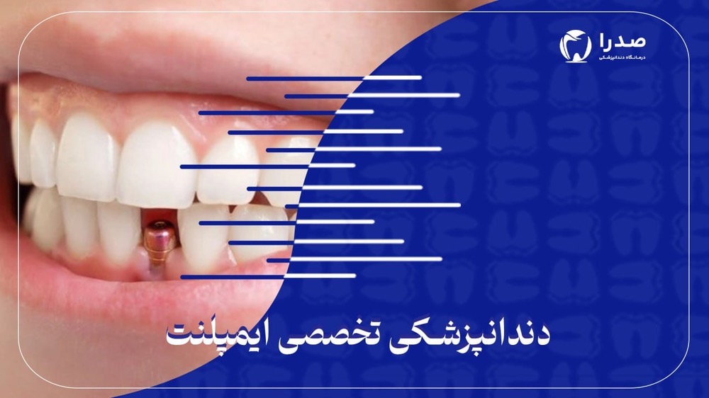 دندانپزشکی تخصصی ایمپلنت دندانپزشکی تخصصی ایمپلنت