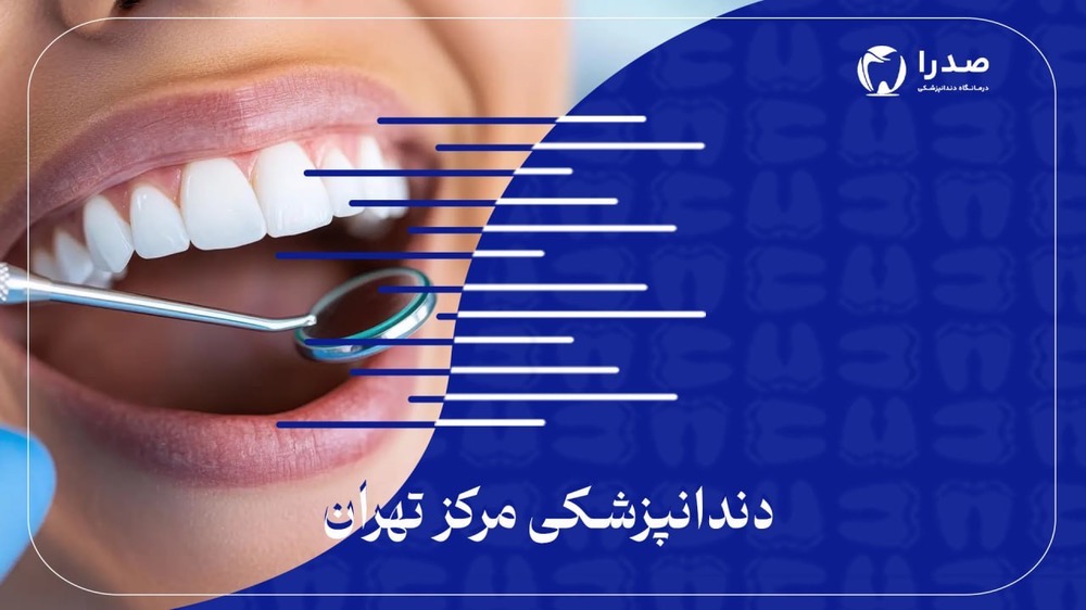 دندانپزشکی مرکز تهران دندانپزشکی مرکز تهران