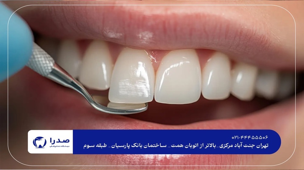 دندانپزشکی مرکز تهران دندانپزشکی مرکز تهران