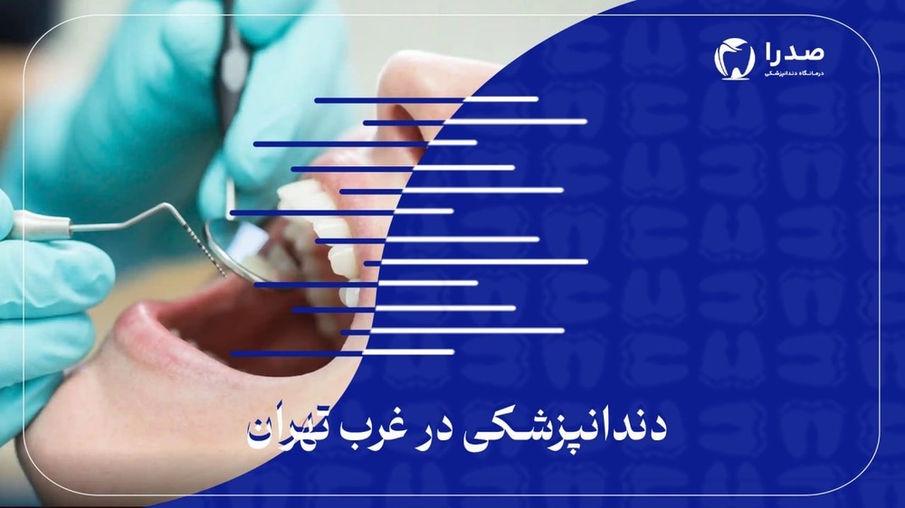 دندانپزشکی در غرب تهران دندانپزشکی در غرب تهران