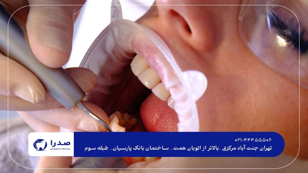 دندانپزشکی تخصصی و شبانه روزی تهران دندانپزشکی تخصصی و شبانه روزی تهران