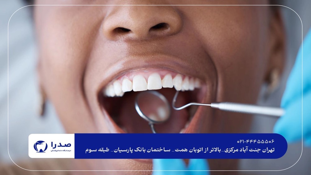 جرم گیری دندان در جنت آباد جرم گیری دندان در جنت آباد