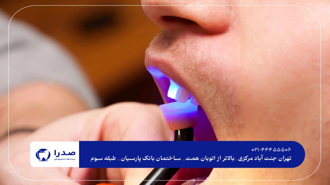 بهترین دندانپزشک عمومی تهران