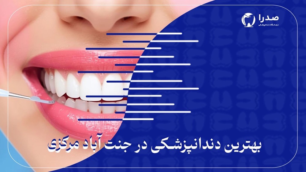 بهترین دندانپزشکی در جنت آباد مرکزی بهترین دندانپزشکی در جنت آباد مرکزی