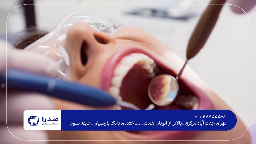 خدمات بهترین دندانپزشکی در جنت آباد مرکزی خدمات بهترین دندانپزشکی در جنت آباد مرکزی