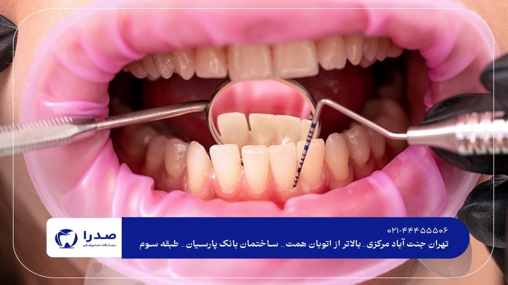 بهترین دندانپزشکی در جنت آباد مرکزی کجاست؟ بهترین دندانپزشکی در جنت آباد مرکزی کجاست؟