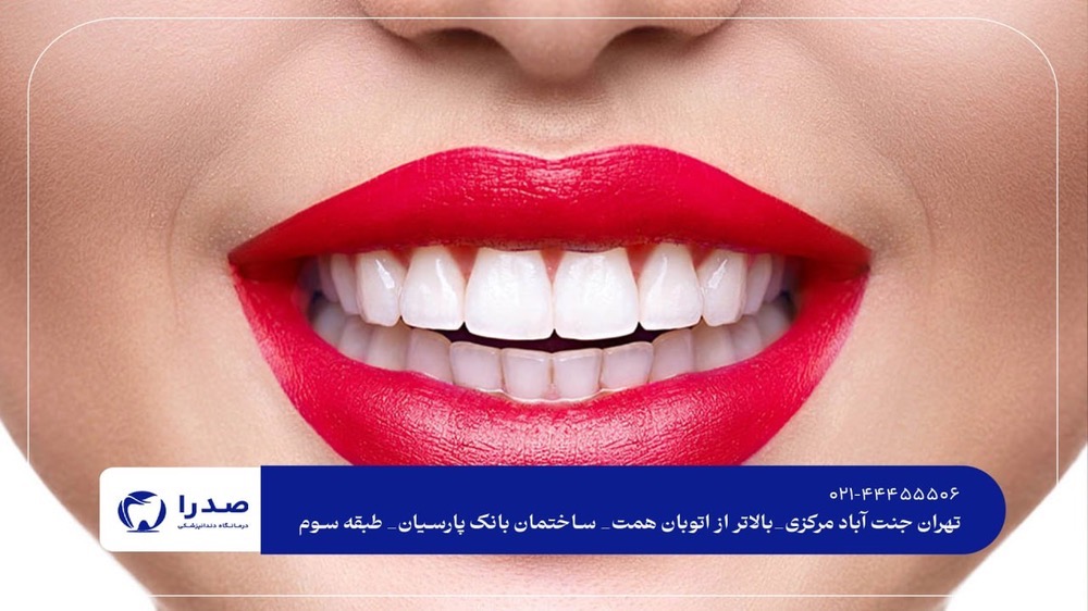 لمینیت و کامپوزیت دندان در کلینیک تخصصی لمینیت و کامپوزیت دندان در کلینیک تخصصی