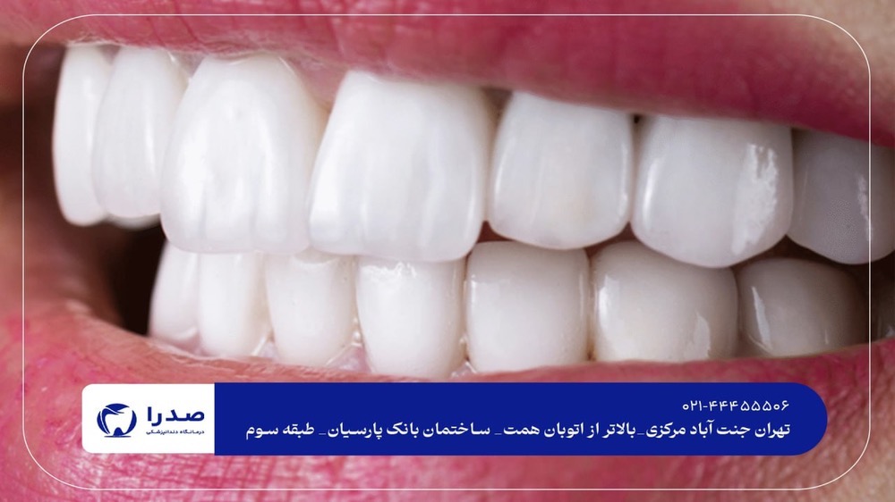 لمینیت و کامپوزیت دندان در کلینیک تخصصی لمینیت و کامپوزیت دندان در کلینیک تخصصی