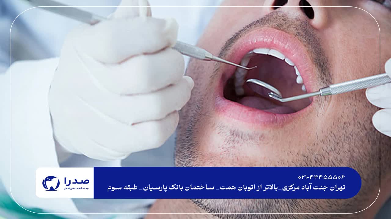 ویزیت دندانپزشکی رایگان در تهران ویزیت دندانپزشکی رایگان در تهران
