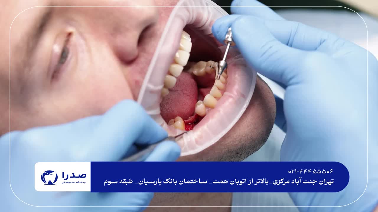 ویزیت دندانپزشکی رایگان در غرب تهران ویزیت دندانپزشکی رایگان در غرب تهران