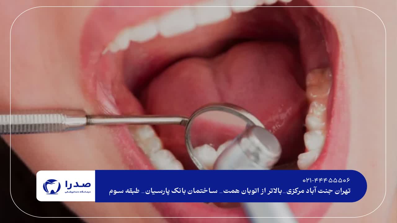 دندانپزشک عمومی تهران دندانپزشک عمومی تهران