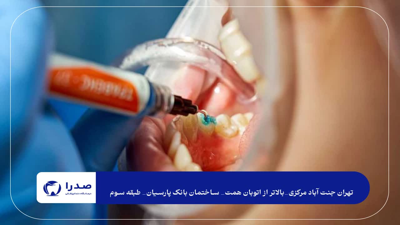 مشاوره قبل از درمان دندانپزشکی مشاوره قبل از درمان دندانپزشکی