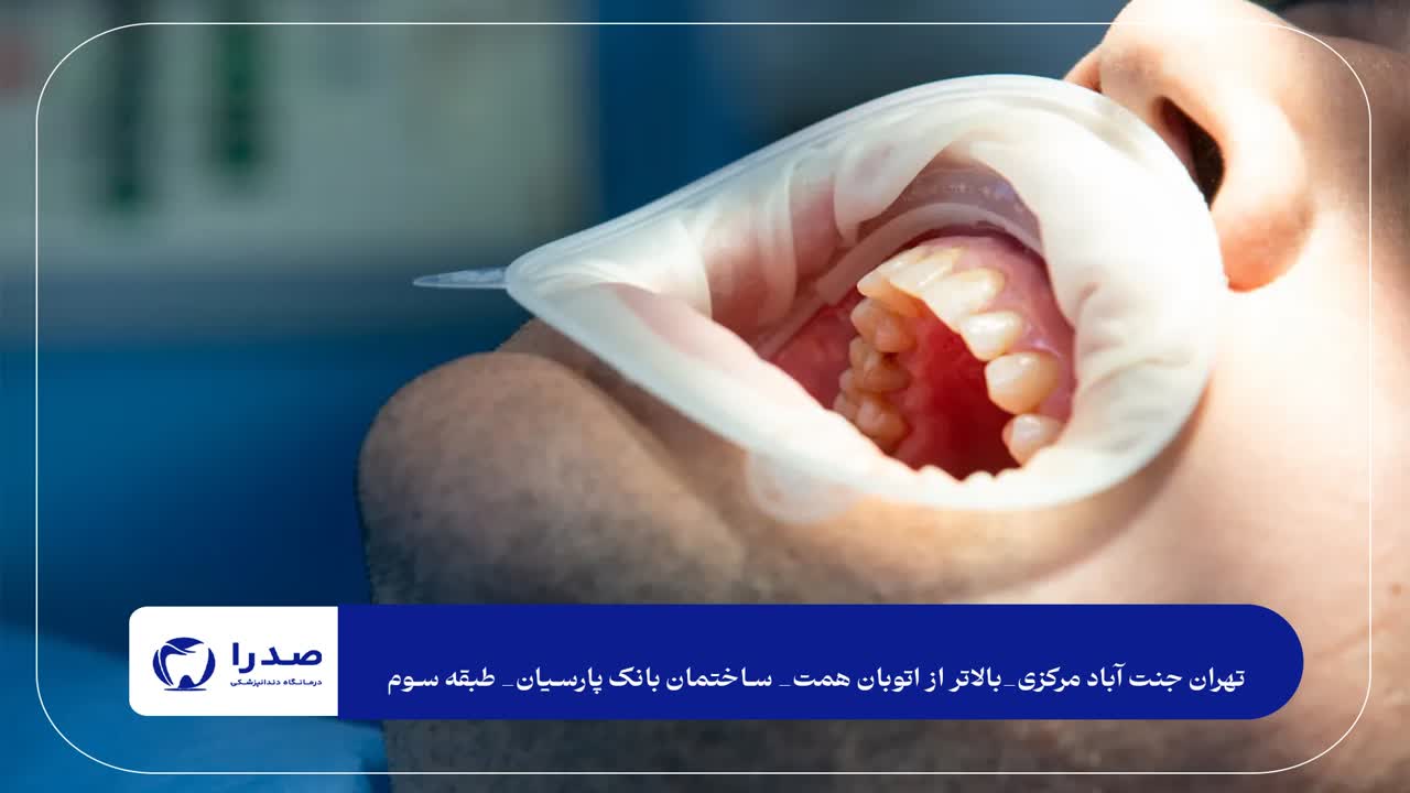 مشاوره قبل از درمان دندانپزشکی مشاوره قبل از درمان دندانپزشکی