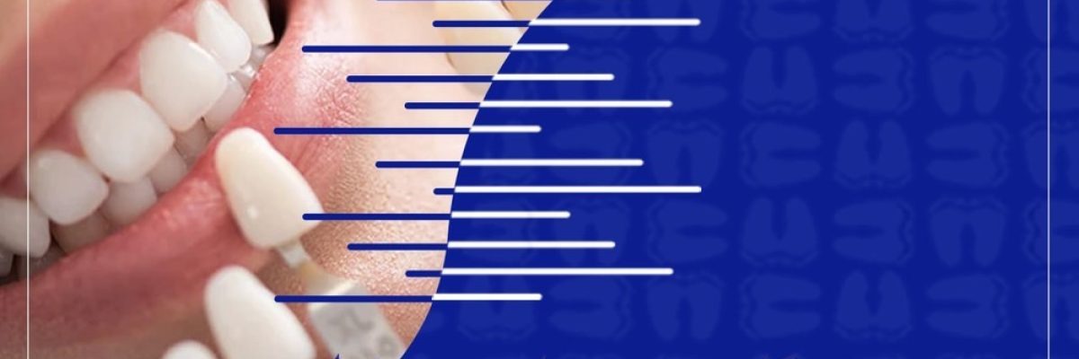  کامپوزیت و لمینت دندان