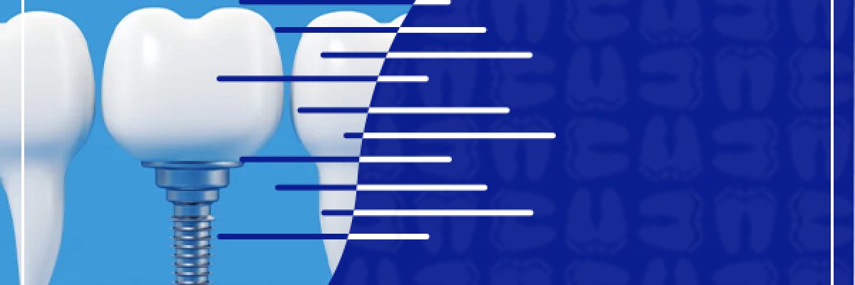 بهترین دندانپزشک ایمپلنت در غرب تهران
