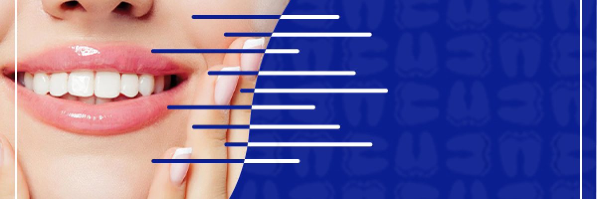 فرق بین لمینت و کامپوزیت دندان