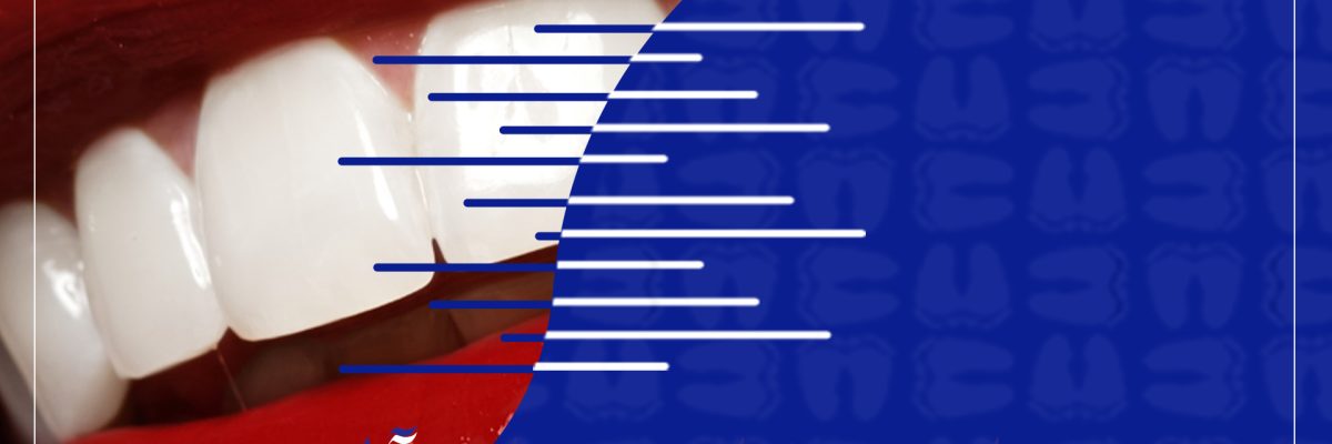 لمینت دندان در سعادت آباد